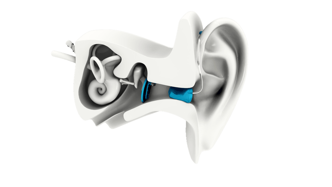 Earlens 3D render